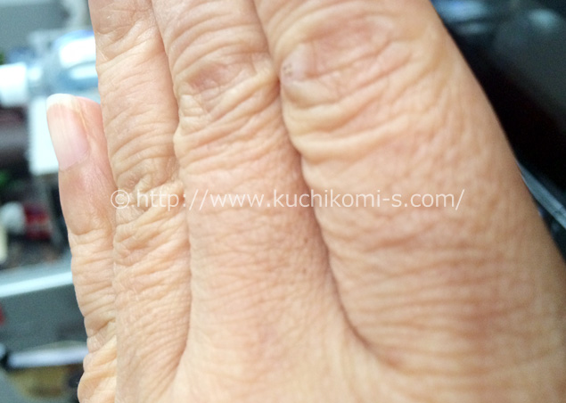 左手の指 1ヶ月前お手入れ「毛穴が目立ちますが、毛は生えていません」